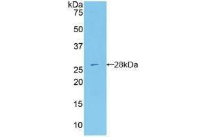 Detection of Recombinant RIG1, Mouse using Polyclonal Antibody to Probable ATP-dependent RNA Helicase DDX58 (DDX58) (DDX58 antibody  (AA 1-211))