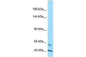 Western Blotting (WB) image for anti-Ras Association and DIL Domains (Radil) (C-Term) antibody (ABIN2789578)