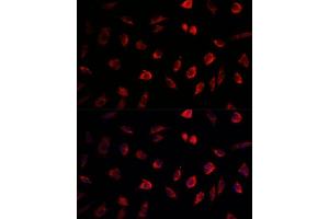 Immunofluorescence (IF) image for anti-Neural Precursor Cell Expressed, Developmentally Down-Regulated 1 (NEDD1) (AA 411-660) antibody (ABIN1681008)