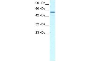 WB Suggested Anti-EBF3 Antibody Titration: 2. (EBF3 antibody  (Middle Region))