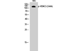 Western Blotting (WB) image for anti-Histone Deacetylase 5 (HDAC5) (pSer498) antibody (ABIN5956856) (HDAC5 antibody  (pSer498))