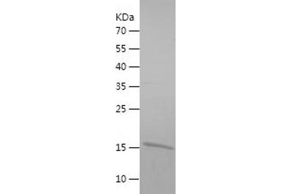 SSBP1 Protein (AA 17-148) (His tag)