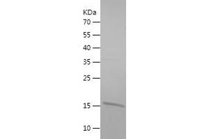Western Blotting (WB) image for Single-Stranded DNA Binding Protein 1 (SSBP1) (AA 17-148) protein (His tag) (ABIN7283859) (SSBP1 Protein (AA 17-148) (His tag))