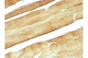 Formalin-fixed, paraffin-embedded Rat Skeletal Muscle stained with Muscle Specific Actin Mouse Monoclonal Antibody (MSA/953). (ACTA1/ACTA2A/ACTG2 antibody)