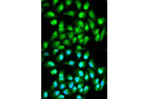 Immunofluorescence analysis of HeLa cells using RAN antibody. (RAN antibody)