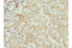 Immunohistochemistry of paraffin-embedded human liver tissue using ABIN7156320 at dilution of 1:100 (ITPK1 antibody  (AA 185-414))