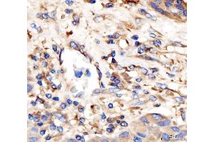 IHC analysis of AP2A2 using anti-AP2A2 antibody (ABIN7602295).