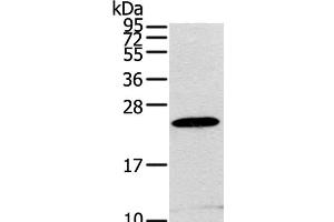 Western Blot analysis of RAW264. (RGS1 antibody)