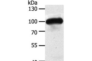 Western Blot analysis of Mouse heart tissue using MAP4K3 Polyclonal Antibody at dilution of 1:400 (MAP4K3 antibody)