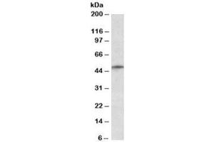 Western blot testing of K562 lysate with TRIM35 antibody at 1ug/ml. (TRIM35 antibody)