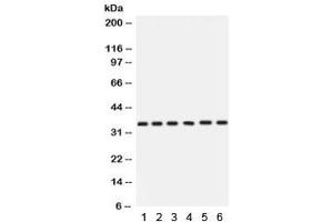 Western blot testing of 1) rat stomach, 2) rat thymus, 3) human HeLa, 4) A549, 5) SKOV and 6)  22RV1 with Cdk4 antibody. (CDK4 antibody  (AA 201-303))
