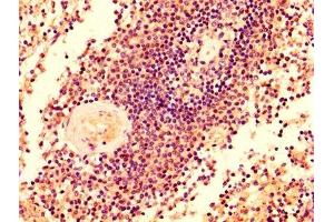 IHC image of ABIN7145433 diluted at 1:500 and staining in paraffin-embedded human spleen tissue performed on a Leica BondTM system. (GRK2 antibody  (AA 2-221))
