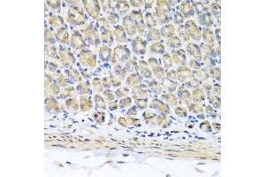Immunohistochemistry of paraffin-embedded mouse stomach using STK3 antibody at dilution of 1:100 (x40 lens). (STK3 antibody)