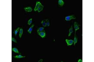 Immunofluorescence (IF) image for anti-Integrator Complex Subunit 9 (INTS9) (AA 368-658) antibody (ABIN7156421)