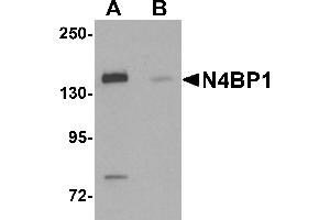 Western blot analysis of N4BP1 in HeLa cell lysate with N4BP1 antibody at 0. (N4BP1 antibody  (N-Term))