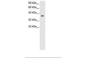 Image no. 1 for anti-5'-Nucleotidase, Cytosolic III (NT5C3) (AA 185-234) antibody (ABIN6735799) (NT5C3 antibody  (AA 185-234))