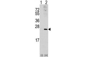 Western blot analysis of RAC1 antibody and 293 cell lysate (2 ug/lane) either nontransfected (Lane 1) or transiently transfected with the RAC1 gene (2). (RAC1 antibody  (AA 49-78))