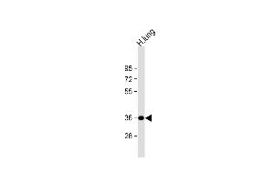 Anti-GRINA Antibody (Center) at 1:1000 dilution + human lung lysate Lysates/proteins at 20 μg per lane. (GRINA antibody  (AA 117-146))