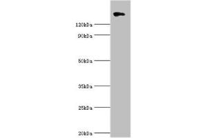 Western blot All lanes: Collagen alpha-1 (II) chain antibody at 10 μg/mL + 293T whole cell lysate Secondary Goat polyclonal to rabbit IgG at 1/10000 dilution Predicted band size: 142, 135, 30 kDa Observed band size: 142 kDa