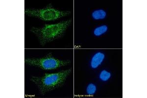 Immunofluorescence staining of HeLa cells using anti-CD171. (Recombinant L1CAM antibody)