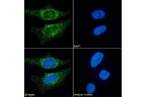 Immunofluorescence staining of HeLa cells using anti-CD171.