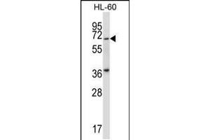 Western blot analysis in HL-60 cell line lysates (35ug/lane). (PKMYT1 antibody  (N-Term))
