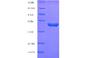 SDS-PAGE (SDS) image for Inhibin, alpha (INHA) (AA 227-360) protein (His-SUMO Tag) (ABIN5709759)