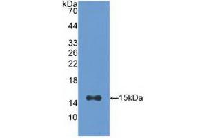 Western blot analysis of recombinant Human ACO1. (Aconitase 1 antibody  (AA 458-586))