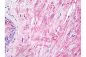 Human Prostate, Smooth Muscle: Formalin-Fixed, Paraffin-Embedded (FFPE) (Vinculin antibody  (AA 356-607))
