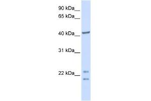 WB Suggested Anti-C16orf48 Antibody Titration:  0. (ENKD1 antibody  (C-Term))