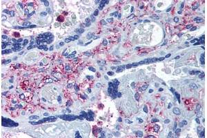 Anti-ADAMTS5 antibody  ABIN1048292 IHC staining of human placenta. (ADAMTS5 antibody  (Internal Region))