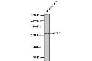 Western blot analysis of extracts of Mouse brain using GTF2I Polyclonal Antibody at dilution of 1:500. (GTF2I antibody)