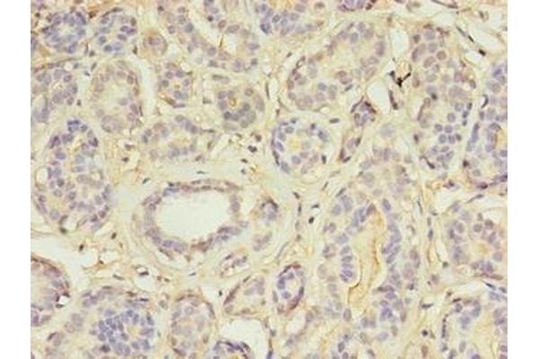 MAP3K7CL antibody  (AA 1-142)