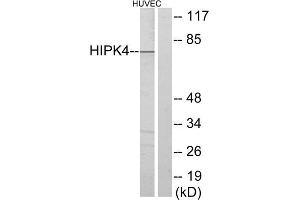 Western blot analysis of extracts from HUVEC cells, using HIPK4 antibody. (HIPK4 antibody  (C-Term))