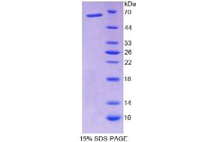 SDS-PAGE analysis of Rat NFIX Protein. (NFIX Protein)
