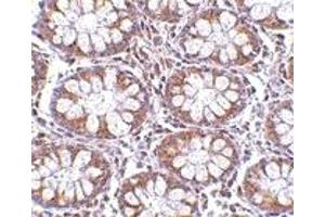 Immunohistochemistry (IHC) image for anti-CD248 Molecule, Endosialin (CD248) (C-Term) antibody (ABIN1030727) (CD248 antibody  (C-Term))