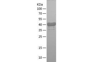 Western Blotting (WB) image for Hyaluronan-Mediated Motility Receptor (RHAMM) (HMMR) (AA 1-300) protein (His tag) (ABIN7282560) (HMMR Protein (AA 1-300) (His tag))