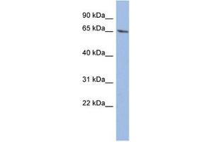 Western Blotting (WB) image for anti-Wilms Tumor 1 (WT1) (C-Term) antibody (ABIN604665) (WT1 antibody  (C-Term))