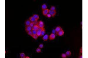 Immunofluorescence (IF) image for anti-Cadherin 1, Type 1, E-Cadherin (Epithelial) (CDH1) antibody (Alexa Fluor 594) (ABIN2656828) (E-cadherin antibody  (Alexa Fluor 594))