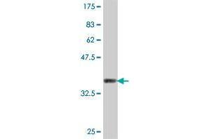 Western Blot detection against Immunogen (37 KDa) . (SSH3 antibody  (AA 293-391))