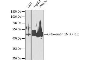 Western blot analysis of extracts of various cell lines, using Cytokeratin 16 (KRT16) antibody (ABIN6129541, ABIN6143021, ABIN6143022 and ABIN6223391) at 1:1000 dilution. (KRT16 antibody  (AA 190-430))