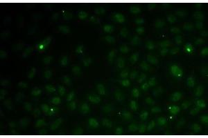 Immunofluorescence analysis of MCF7 cells using RAD51C Polyclonal Antibody (RAD51C antibody)