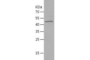 Western Blotting (WB) image for Acetylcholine Receptor Subunit alpha (CHRNA1) (AA 21-230) protein (His-IF2DI Tag) (ABIN7121647) (CHRNA1 Protein (AA 21-230) (His-IF2DI Tag))