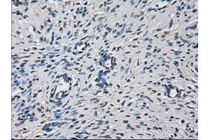 Immunohistochemical staining of paraffin-embedded liver tissue using anti-PRLmouse monoclonal antibody.