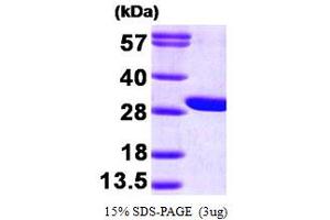 SDS-PAGE (SDS) image for Guanidinoacetate N-Methyltransferase (GAMT) (AA 1-236) protein (His tag) (ABIN666910)