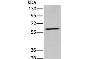 Western blot analysis of Human fetal brain tissue lysate using GPC5 Polyclonal Antibody at dilution of 1:450 (GPC5 antibody)