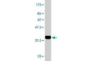 Western Blot detection against Immunogen (34. (LASS4 antibody  (AA 57-139))