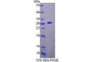 SDS-PAGE analysis of Mouse YAF2 Protein. (YAF2 Protein)
