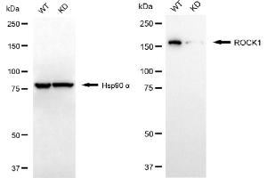 Western blotting analysis using ROCK1 antibody (ABIN7800202). (Recombinant ROCK1 antibody)