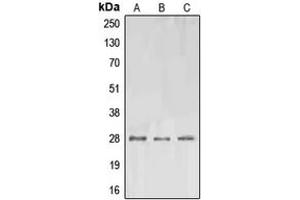 Western blot analysis of EPO expression in A549 (A), SP2/0 (B), PC12 (C) whole cell lysates. (EPO antibody  (Center))